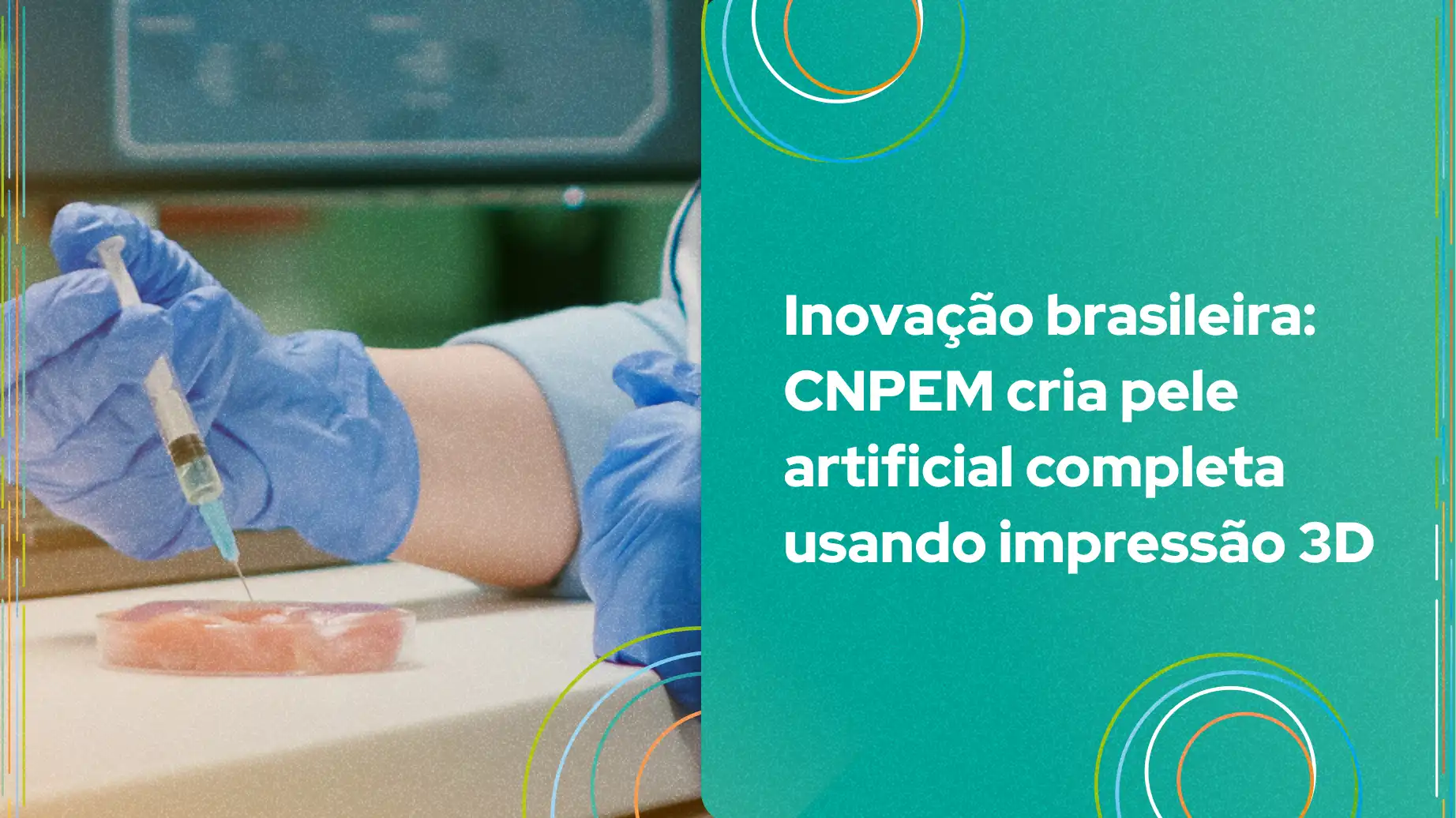 Imagem que destaca a inovação brasileira do CNPEM na criação de pele artificial completa usando tecnologia de impressão 3D. Um profissional em laboratório realiza manipulações com luvas azuis e seringa.