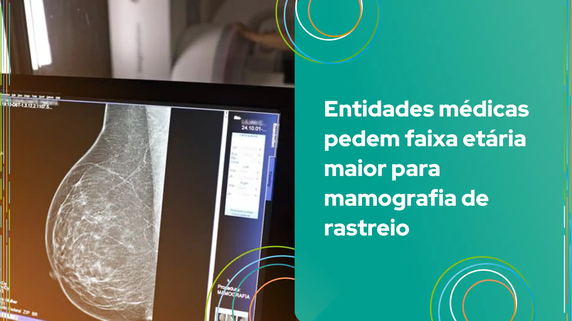 Imagem de um exame de mamografia digital, evidenciando a importância da detecção precoce e o pedido das entidades médicas por faixa etária maior para o rastreio.