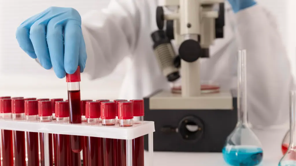 Laboratório realizando exame de sangue para Alzheimer com alta precisão, acima de 90%, utilizando tecnologia avançada para diagnóstico preciso.