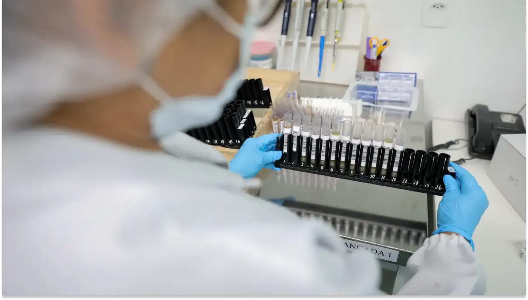 Profissional em laboratório com luvas azuis preparando frascos e tubos de amostras de malária em uma bancada, ao lado de pipetas, racks e equipamentos de análise
