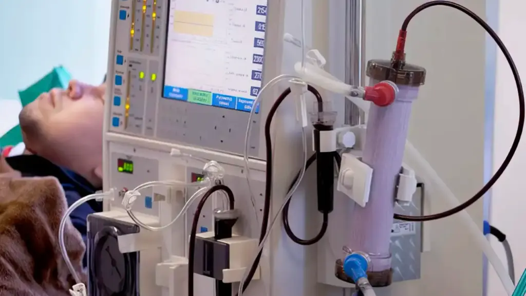Cenário hospitalar com equipamentos de diálise, tubos e conexões ligados a uma máquina ao lado de um paciente em um leito, ilustrando ambiente de tratamento para doença renal.